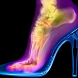 foot x-ray